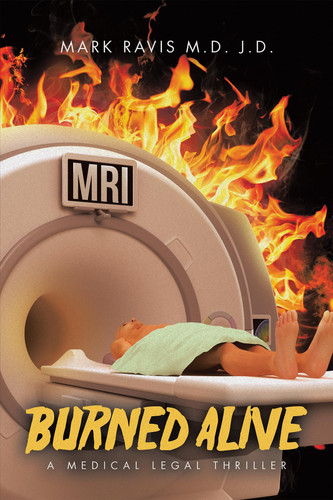 Burned Alive: A Medical Legal Thriller by Ravis J D M D, Mark