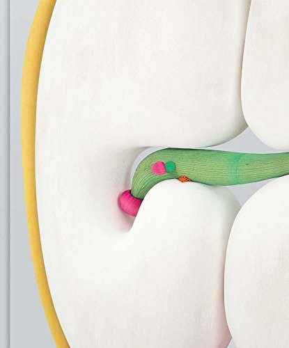 Matthew Ronay by Matthew Ronay