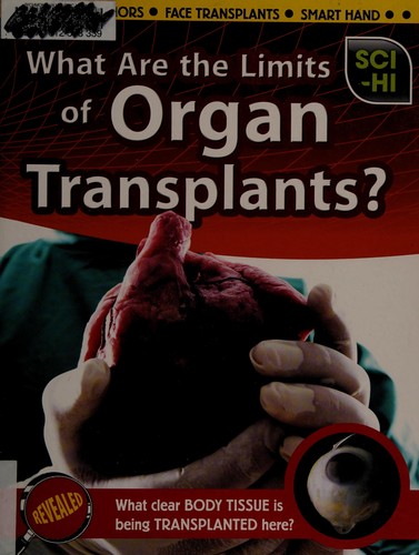 What Are the limits of organ transplants? by Anna Claybourne